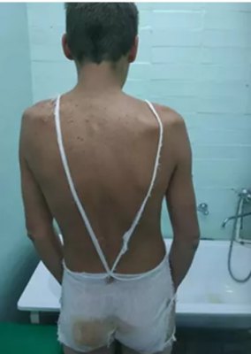Пьяные саратовские полицейские жгли подозреваемого утюгом.
